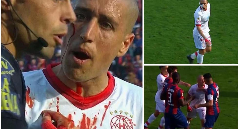 Futbolista discutió con un rival, pero recibió golpe de su compañero y acabó sangrando 