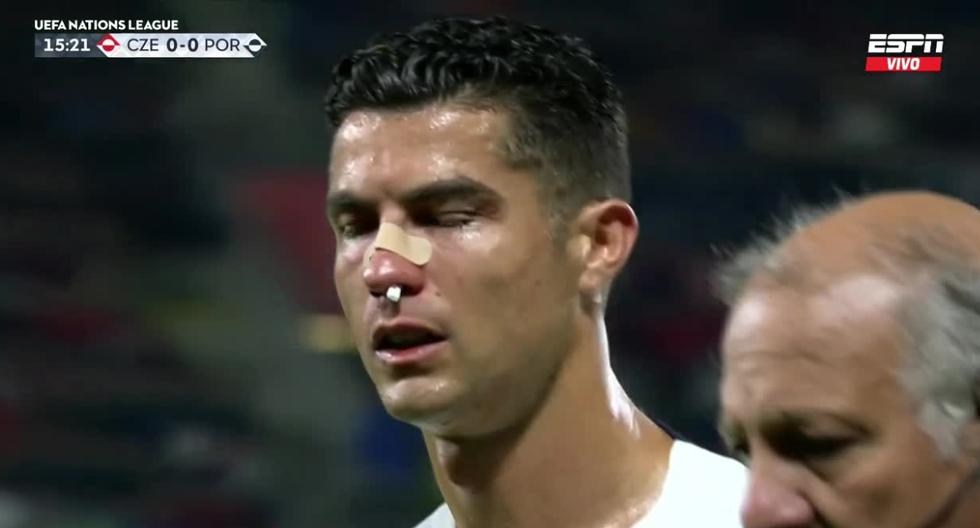 Con sangre en el rostro: Cristiano Ronaldo y su fuerte golpe en el Portugal vs. República Checa