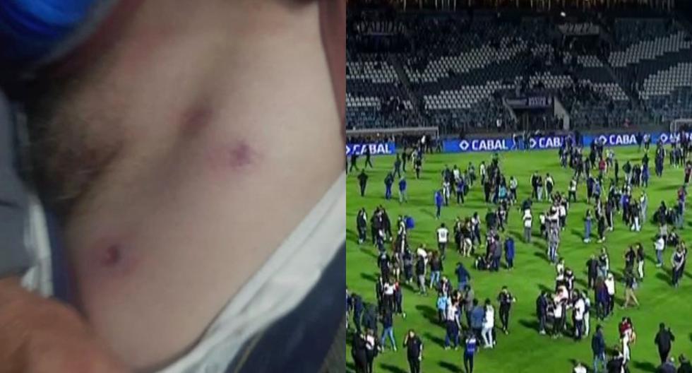 Fuerte escena: periodista argentino fue herido por bala de goma en el incidente de Boca vs. Gimnasia 