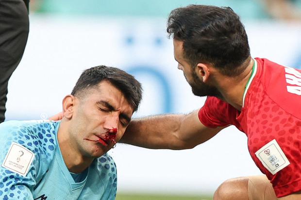 Alireza Beiranvand, portero de Irán, sufrió terrible lesión tras chocar con su compañero. (Foto: EFE)