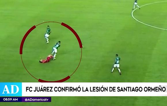 Confirman lesión de Santiago Ormeño (AméricaTV)