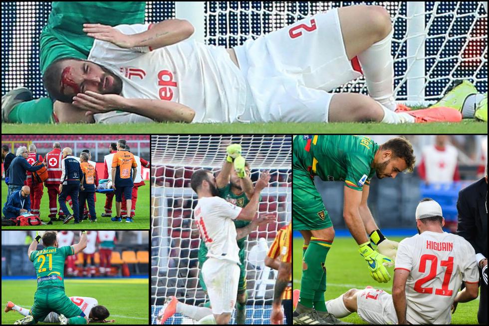 Gonzalo Higuaín recibió terrible codazo en su partido 200 en la Serie A: Terrible herida y sangrado