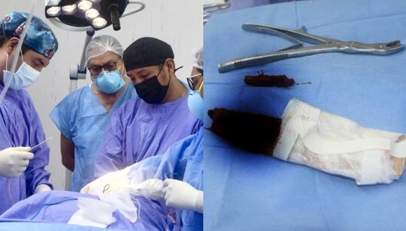 Instituto Nacional de Ciencias Neurológicas salva vida de joven que se le incrustó una tabla de 2 metros en el ojo y cerebro. (Foto: Minsa)