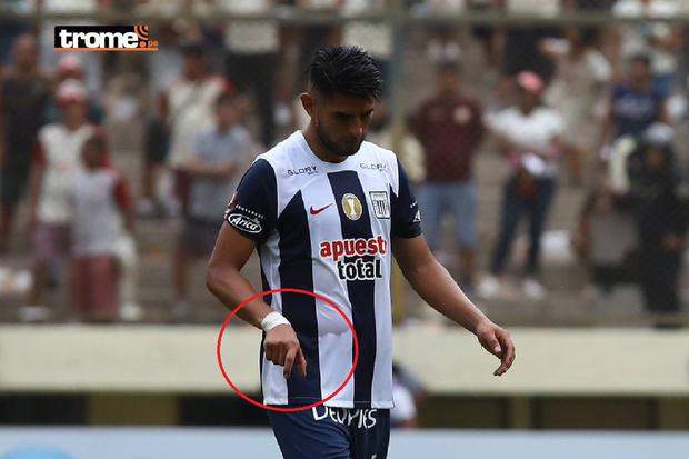 Polémico gesto de Carlos Zambrano, tras ser expulsado en el Clásico Alianza Lima - Universitario. (Foto: Leonardo Fernández / @photo.gec)