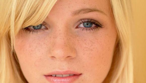 “Las pecas son acumulaciones de pigmento que aparecen en todo el rostro, pero sobre todo en aquellas zonas más expuestas al sol: las mejillas y la nariz", dice especialista. (Foto: Difusión)